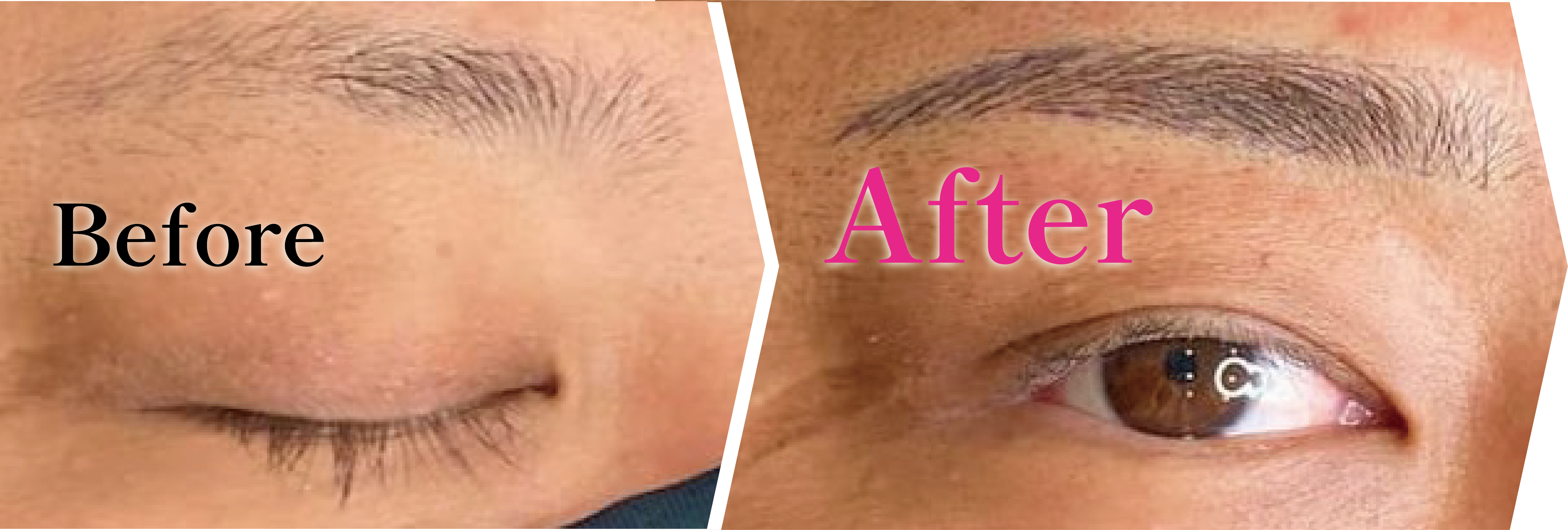 beauty katze　眉毛タトゥー前後